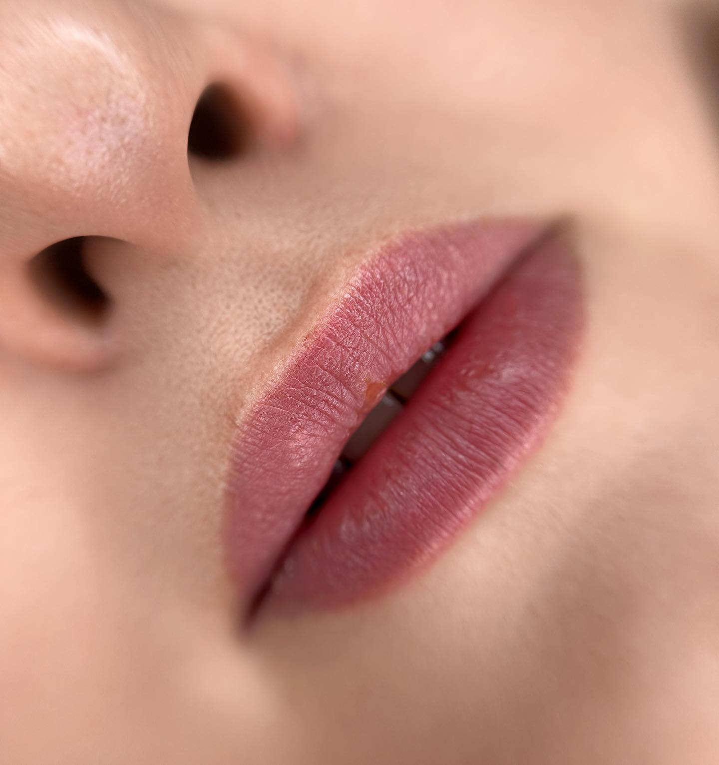 Huulten muotoilu — Albina Räsänen Aesthetics